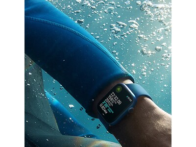 Apple Watch Series 7 GPS + Cellular,  MM Starlight Aluminum Case with  Starlight Sport Band Renewed